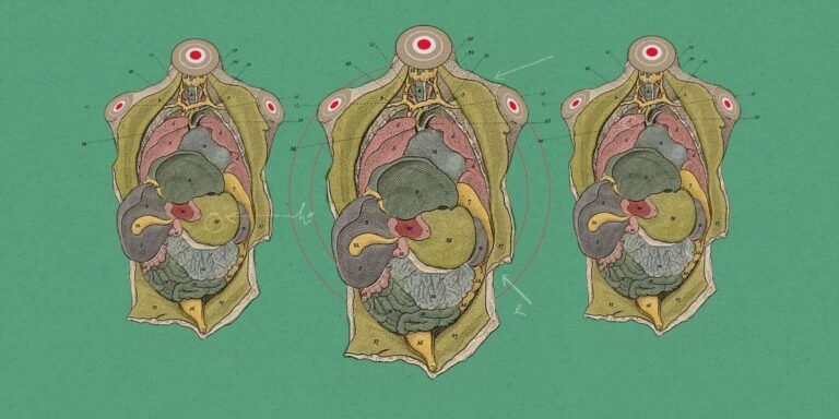 “Spare” living human bodies might provide us with organs for transplantation