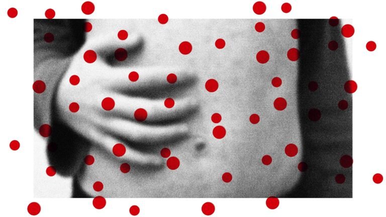 Measles Cases Are Rising. Other Preventable Diseases Could Follow