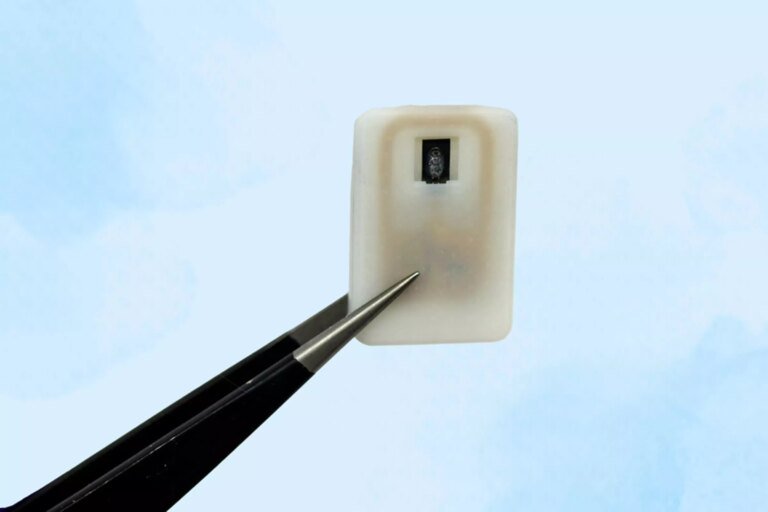 New MIT implant automatically treats dangerously low blood sugar in people with type 1 diabetes