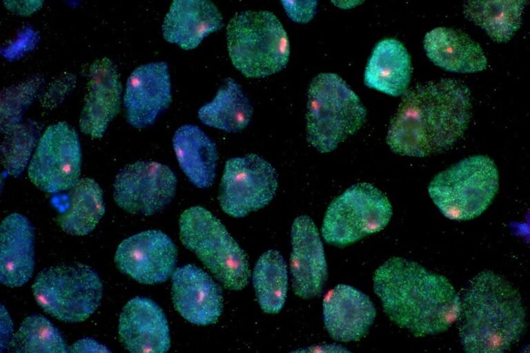 Successful human trial: Scientists program cancer-fighting T cells that self-replicate Successful human trial: Scientists program cancer-fighting T cells that self-replicate