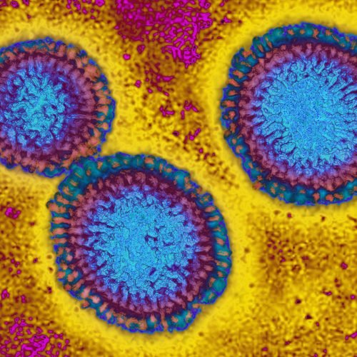 This flu season looks grim as H3N2 emerges with mutations This flu season looks grim as H3N2 emerges with mutations