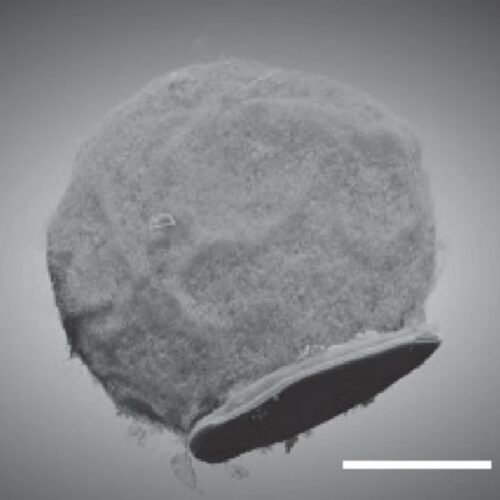 Tiny chips hitch a ride on immune cells to sites of inflammation Tiny chips hitch a ride on immune cells to sites of inflammation