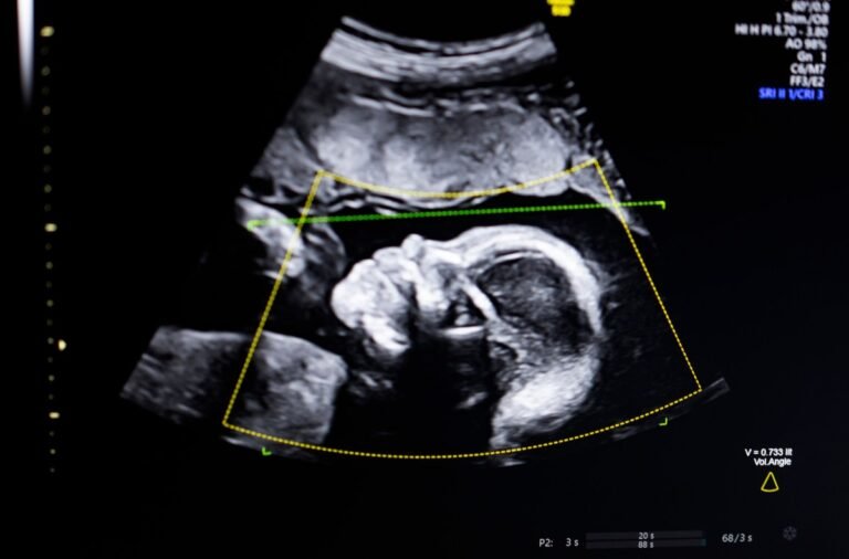 BioticsAI, which won Disrupt’s Battlefield competition in 2023, gains FDA approval for its AI-powered fetal ultrasound product BioticsAI, which won Disrupt’s Battlefield competition in 2023, gains FDA approval for its AI-powered fetal ultrasound product